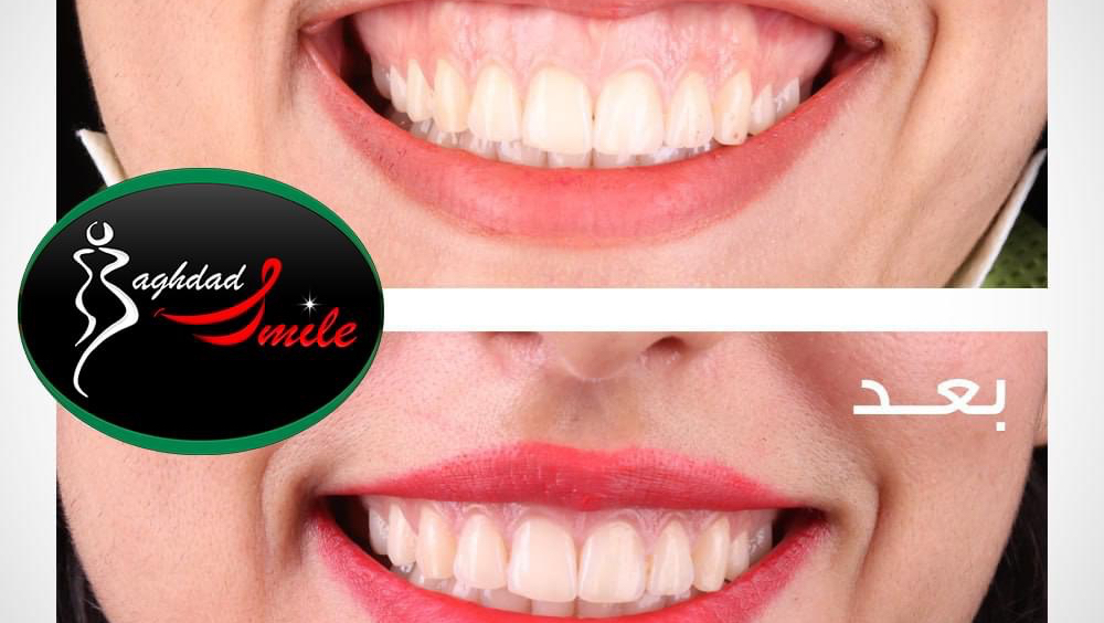 Baghdad Smile Clinics