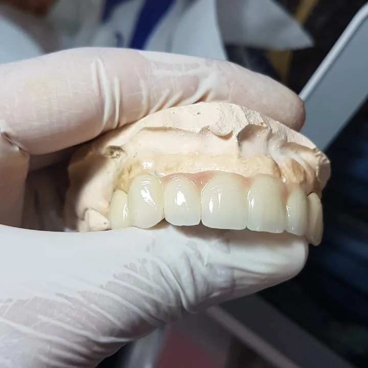 مختبر العراق لصناعة الأسنان